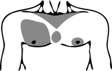 In this study, four parts of the chest in which terminal hair occurs were identified: Chest Hair Wikipedia