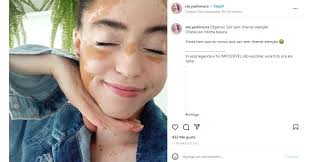 La modelo brasileña, Stephanie Yashimura de 28 años rompe estereotipos de  belleza al mostrar con orgullo su vitíligo en redes sociales