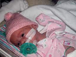 Preemie With Pacifier Preemie Baby Girl Premature Baby Girl Preemie Babies