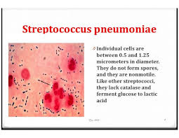 Image result for Penicillin Resistant Pneumococcus