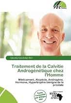 Amazon.fr : Calvitie