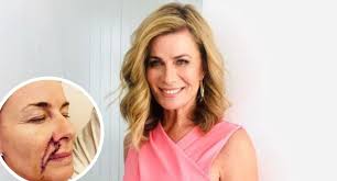 Deborah Hutton reveals horrific scars after major surgery for cancer scare 