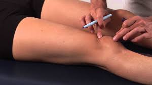 Image result for Ballottable Patella Sign