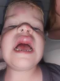 Thank you Jesus. So glad he's safe. I've been worrying about this baby.  Prayers were answered.