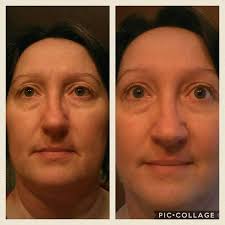 Good morning, gas free home after 8 months