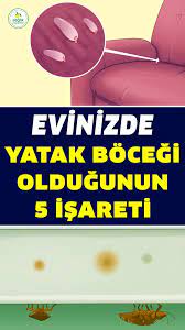 evinizde yatak bocegi tahta kurusu oldugunu gosteren 5 isaret tahta kurusu saglik saglik ipuclari