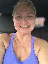 Leflunomide side effects and hair loss improvement?