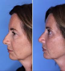 Dr. Thomas Romo III (@drthomasromo) • Instagram photos and videos