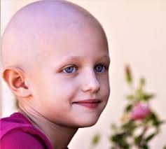 Growing My Hair Out To Support Children With Hair Loss