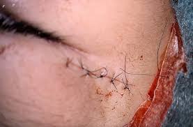 たまプラーザやまぐち眼科