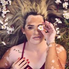 Clínica de Vitiligo