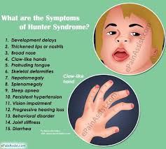 What Are The Symptoms Of Hunter Syndrome Genetic Disorders Pediatric Nursing Syndrome