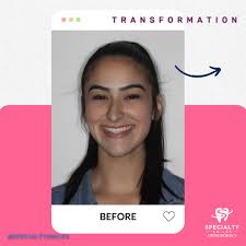 Don't let your smile hold you back! Unleash the power of this smile  transformation! 🤩💫🩷 Schedule Your Consultation Now! 🩵🩷 Call Us ☎️  (305) 822-6784 or DM US 📲 • • • #