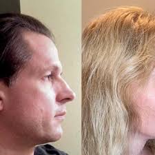 TOBY G. MAYER MD, FACS