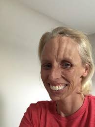 June is Scleroderma Awareness Month! All month we'll be helping you get to  know the face of scleroderma: what it is, who has it and what it's like.  And you'll get to