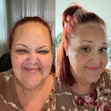 It doesn't serve anyone when you sit around thinking you're a big piece of  crap!” Today I had a small mass removed inside my sinuses. No big deal but  hoping that it's