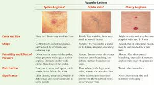 Easy to reference and succinct, this b. Vascular Lesions Spider Angioma Spider Vein Cherry Grepmed