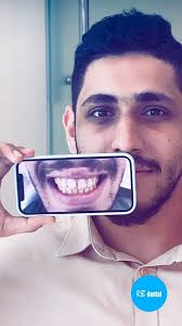 En @rbmelilla transformamos sonrisas con odontología de alta calidad,  moderna y personalizada., 👉Las técnicas de vanguardia se combinan con una  atención compasiva para garantizar que cada paciente se ...