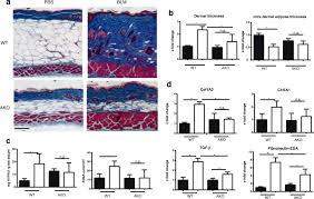 Dana od dana zadnjeg kontakta s oboljelim/boravka u zemlji. Adipocyte Specific Repression Of Ppar Gamma By Ncor Contributes To Scleroderma Skin Fibrosis Arthritis Research Therapy Full Text