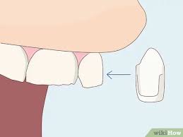 Looking to finally fix something about your smile that you don't like? How To Fix An Uneven Smile And Look Your Best