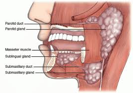 Image result for Sialolithiasis