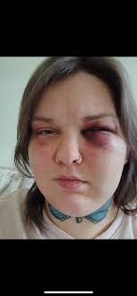 it needs to be easier to get disability during or after domestic violence  and abuse situations. food assistance. housing. everything. the weight left 