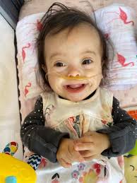 American Academy of Pediatrics & Global Down Syndrome Foundation  Collaborate