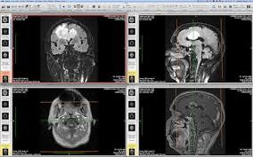 Open View And Read Dicom Dcm Medical Images In Mac Os X Ios With Osirix Mac Os Mac Computer Mac