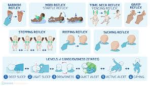 Image result for Babinski Reflex