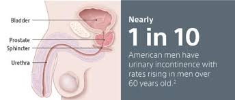 Image result for Stress Incontinence