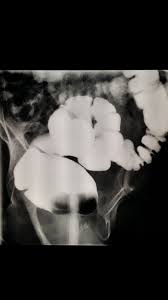 Pin On Radiology