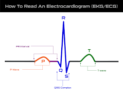 Image result for Electrocardiogram