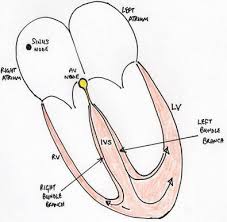 how to read an electrocardiogram ecg part one basic