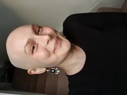 Signs of ovarian cancer: Chloe Etheridge given shock diagnosis at 24 shares  the tiny signs she ignored for months