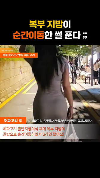 서울365mc병원 | 지방흡입, 람스, 허파고리 | #서울365mc_지방흡입 #서울365mc_팔지방흡입 무더운 여름🔥 일자팔  만들고🙌 끈나시 자주 입게 되죠😆 끈나시+청바지=로망 끝판왕🧡 #끈나시 #민소매나시 #여자들의로망 | Instagram
