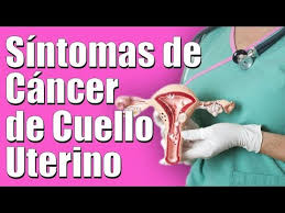 Ahora bien, es necesario que las personas entiendan que la mejor forma de hacerle frente a la misma. Sintomas Causas Y Tratamiento Del Cancer De Cuello Uterino O Cervical Saludablementetv Youtube