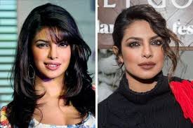 Does Priyanka Chopra Get Lip Injections Quora does priyanka chopra get lip injections