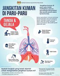 Mulai dari batuk, sesak napas, nyeri, perubahan suara, lelah, bengkak, dan masih banyak lagi. Jangkitan Kuman Di Paru Paru Rafflesia Medical Centre Facebook