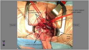 Image result for Chemodectoma