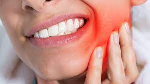 Menempelkan tangan di bagian gigi yang sakit 2. Hanya 5 Menit Begini Cara Menyembuhkan Sakit Gigi Secara Alami Serambi Indonesia