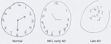 If the client has less than 12 years of formal education, add one point. Montreal Cognitive Assessment Wikiwand