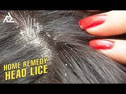 Home Remedy For Head Lice Best Health And Beauty Tips Lifestyle Youtube Beauty Hacks Health And Beauty Tips Beauty Tips For Skin