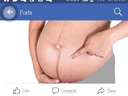 It stretches to accommodate your growing belly and breasts, and it may change color. Pregnancy Are You Pregnant Or Going Through A High Risk Pregnancy Lets Talk Health 4147 Nigeria