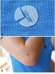 Image result for Glyceryl trinitrate