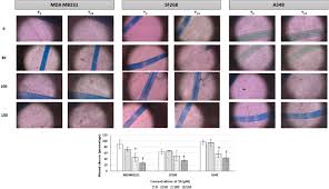 Anticancer effect of new cyclocoumarol derivatives