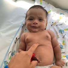 Dra. Gianna Castillo (hematologa pediatra)