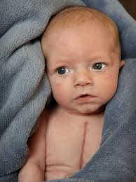 Good Friday Appeal: Geelong baby's nine hour heart surgery at Royal  Children's Hospital