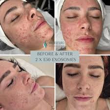 Waterford Skin and Laser Clinic