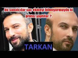 Bu Unluler Sac Ektirmeyi Bilmiyor Muydu Da Protez Sac Yaptirdilar Youtube