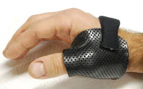 Search for sprain ulnar collateral ligament thumb. Thumb Mcp Ucl Injuries How Much Do We Need To Immobilize